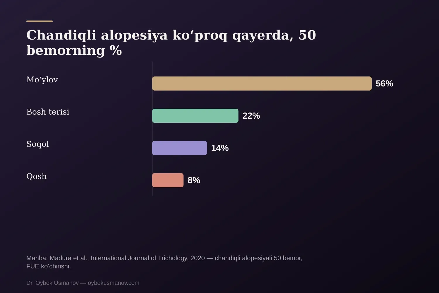 Chandiqli alopesiya koʻproq qayerda