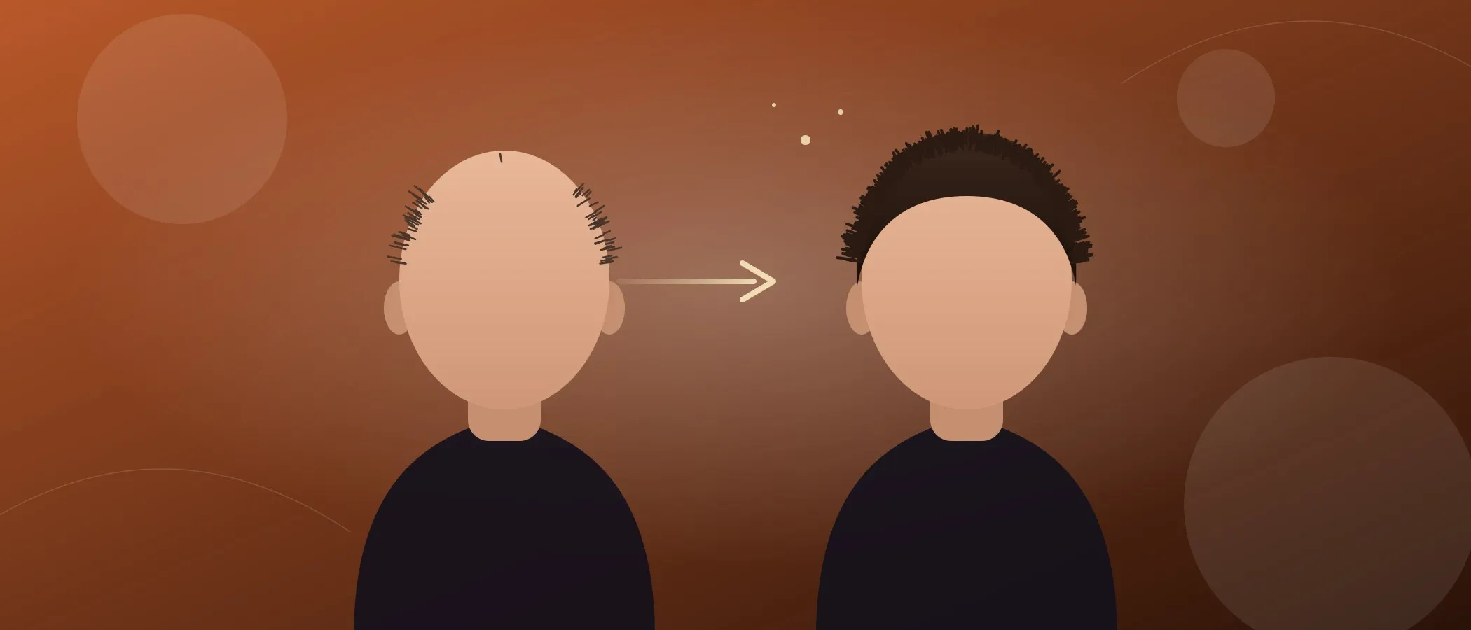 Washing your head after a hair transplant for the first time: scabs, fears and what to do