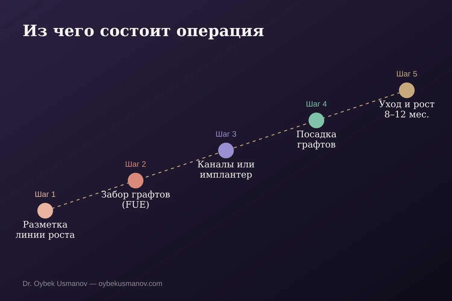Схема этапов пересадки волос: от разметки до роста