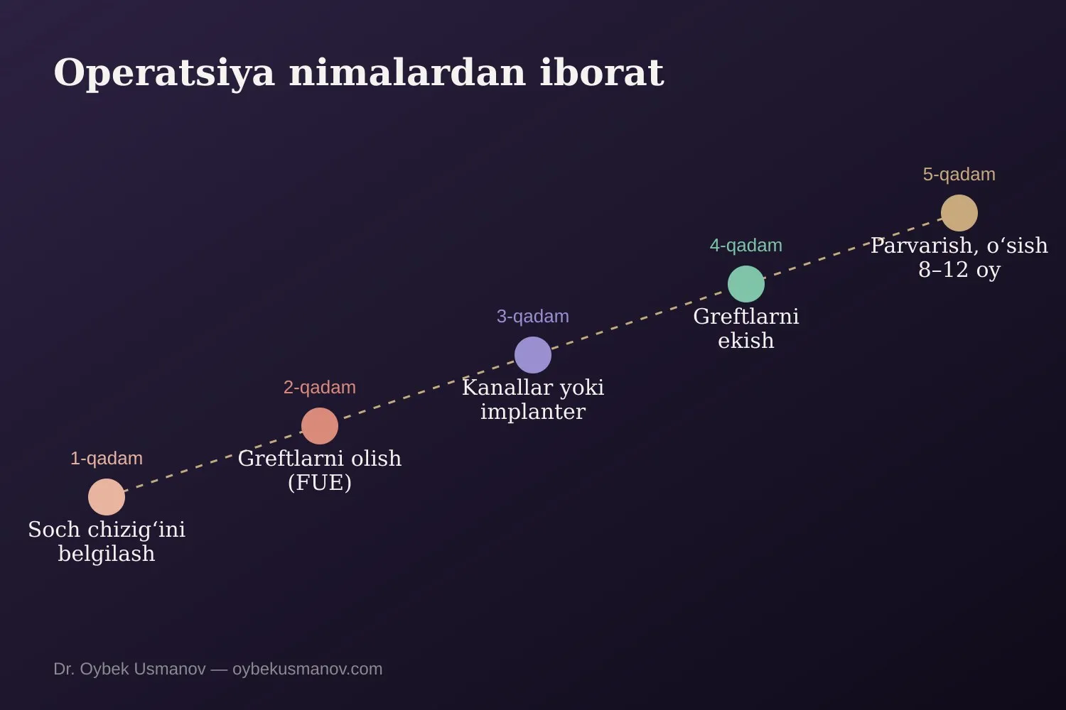 Soch koʻchirish bosqichlari: belgilashdan oʻsishgacha