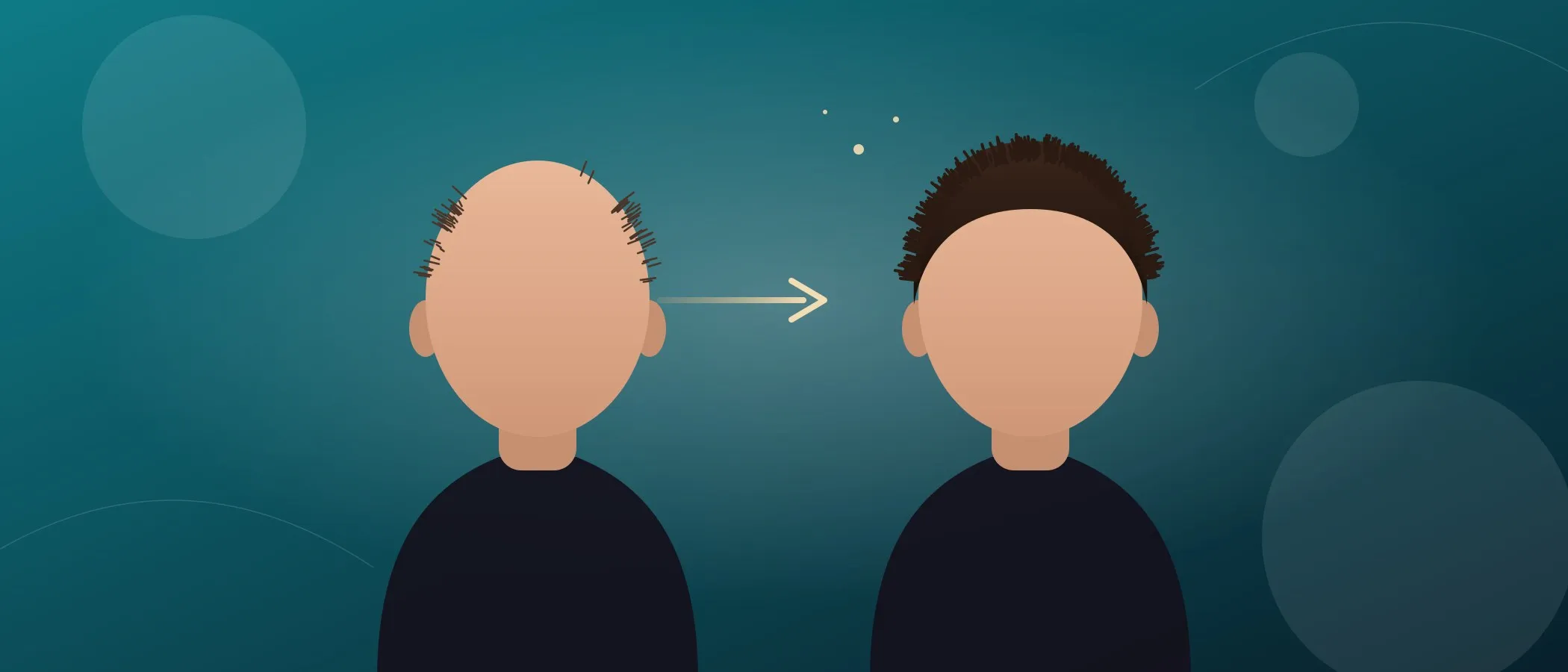 FUE vs DHI: what is the difference, and which should you choose?