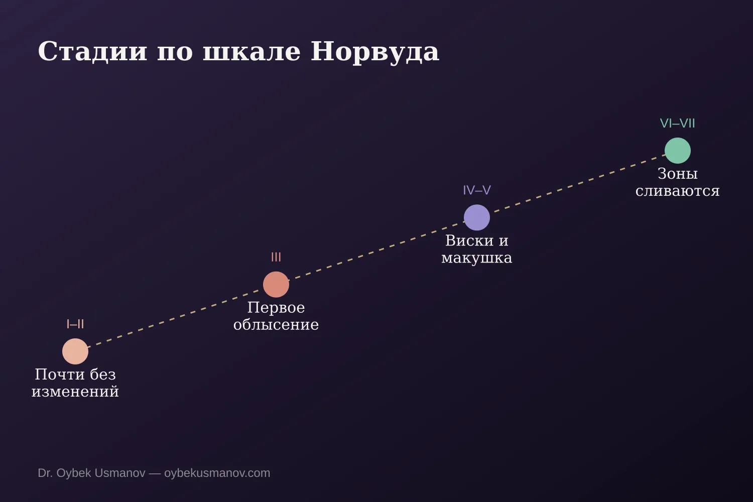 Стадии мужского облысения по шкале Норвуда